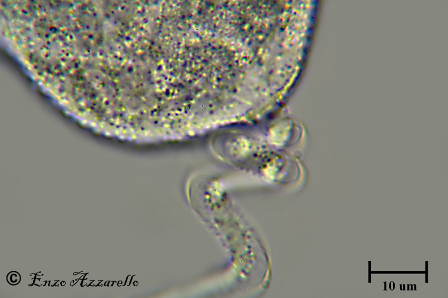 QUESTE FOTO MI PIACCIONO TROPPO! MIONEMA DI VORTICELLA 1000X